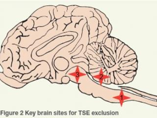 Key brain sites for TSE exclusion.