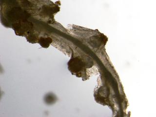 Nematoide do nó da raiz como visto ao microscópio.