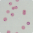 A blood smear from a sheep with eperythrozoonosis. The large gaps between red cells indicate anaemia. The blue-stained organisms within the cells are M. ovis. Photo credit: Mark Bennett, Murdoch U